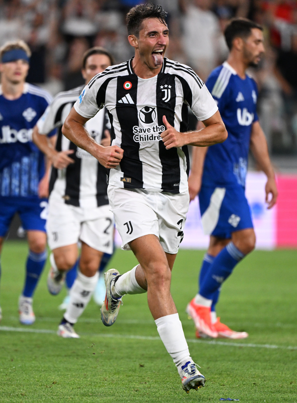 阿斯：阿诺德和卡马文加将在今天接受检查以确定各自伤情（阿斯：阿诺德与卡马文加今日接受检查，评估各自伤势）